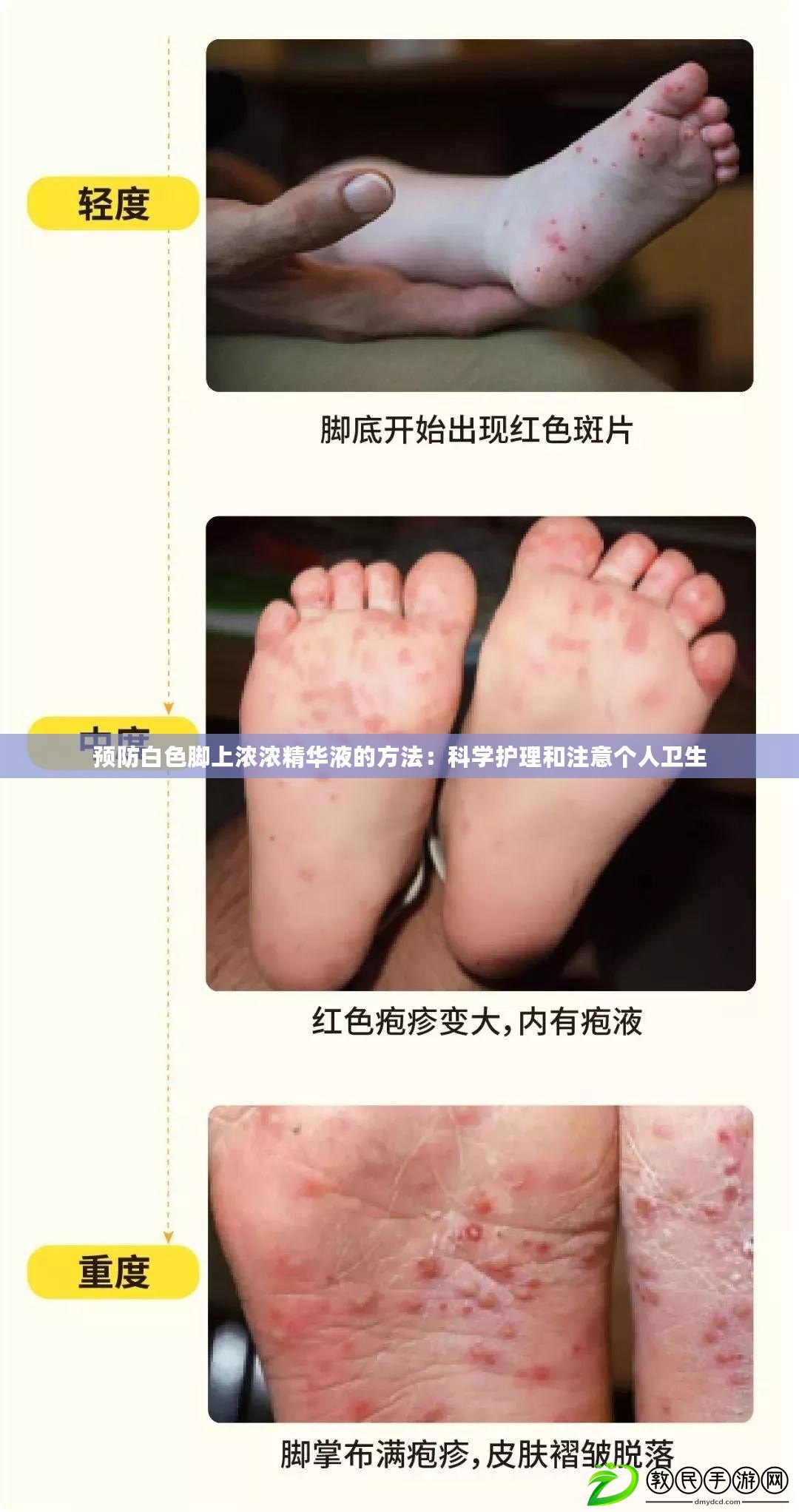預防白色腳上濃濃精華液的方法：科學護理和注意個人衛生