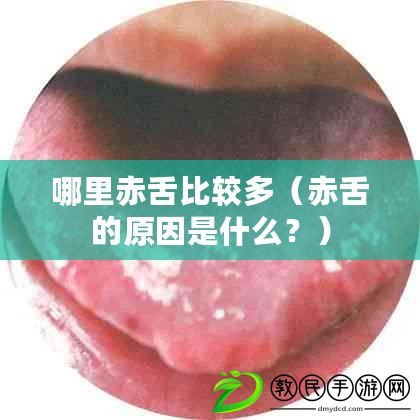 哪里赤舌比較多（赤舌的原因是什么？）