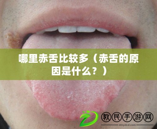 哪里赤舌比較多（赤舌的原因是什么？）