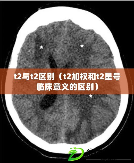 t2與t2區別（t2加權和t2星號臨床意義的區別）